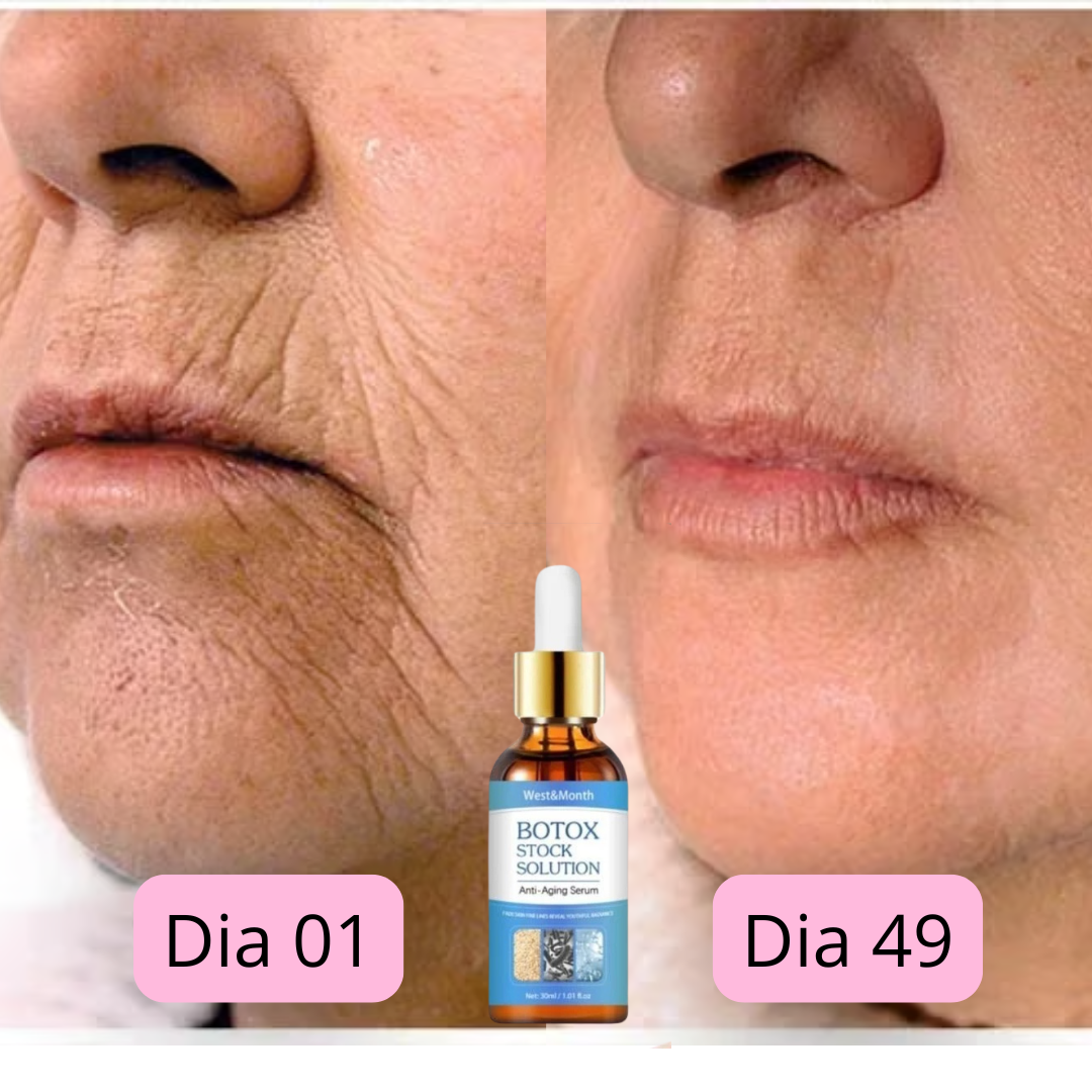 CHEGA AO BRASIL O QUERIDINHO DAS AMERICANAS - 🔥Botox Facial em forma de Sérum - BOTOX STOCK SOLUTION o Sérum Rejuvenescedor com 30ml