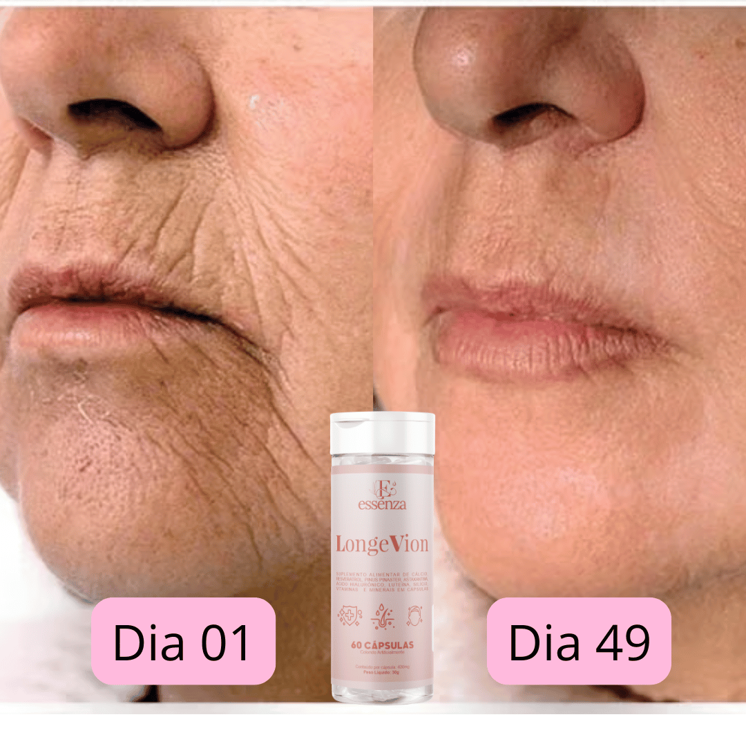 🔥Botox Facial com a ação de DENTRO PARA FORA - LONGEVION o Suplemento Rejuvenescedor com 60 capsulas