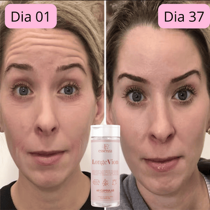 🔥Botox Facial com a ação de DENTRO PARA FORA - LONGEVION o Suplemento Rejuvenescedor com 60 capsulas