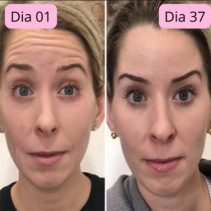 CHEGA AO BRASIL O QUERIDINHO DAS AMERICANAS - 🔥Botox Facial em forma de Sérum - BOTOX STOCK SOLUTION o Sérum Rejuvenescedor com 30ml