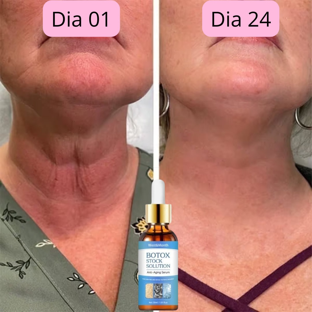 CHEGA AO BRASIL O QUERIDINHO DAS AMERICANAS - 🔥Botox Facial em forma de Sérum - BOTOX STOCK SOLUTION o Sérum Rejuvenescedor com 30ml