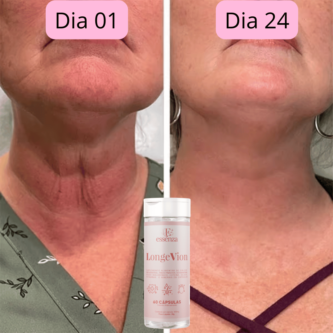 🔥Botox Facial com a ação de DENTRO PARA FORA - LONGEVION o Suplemento Rejuvenescedor com 60 capsulas