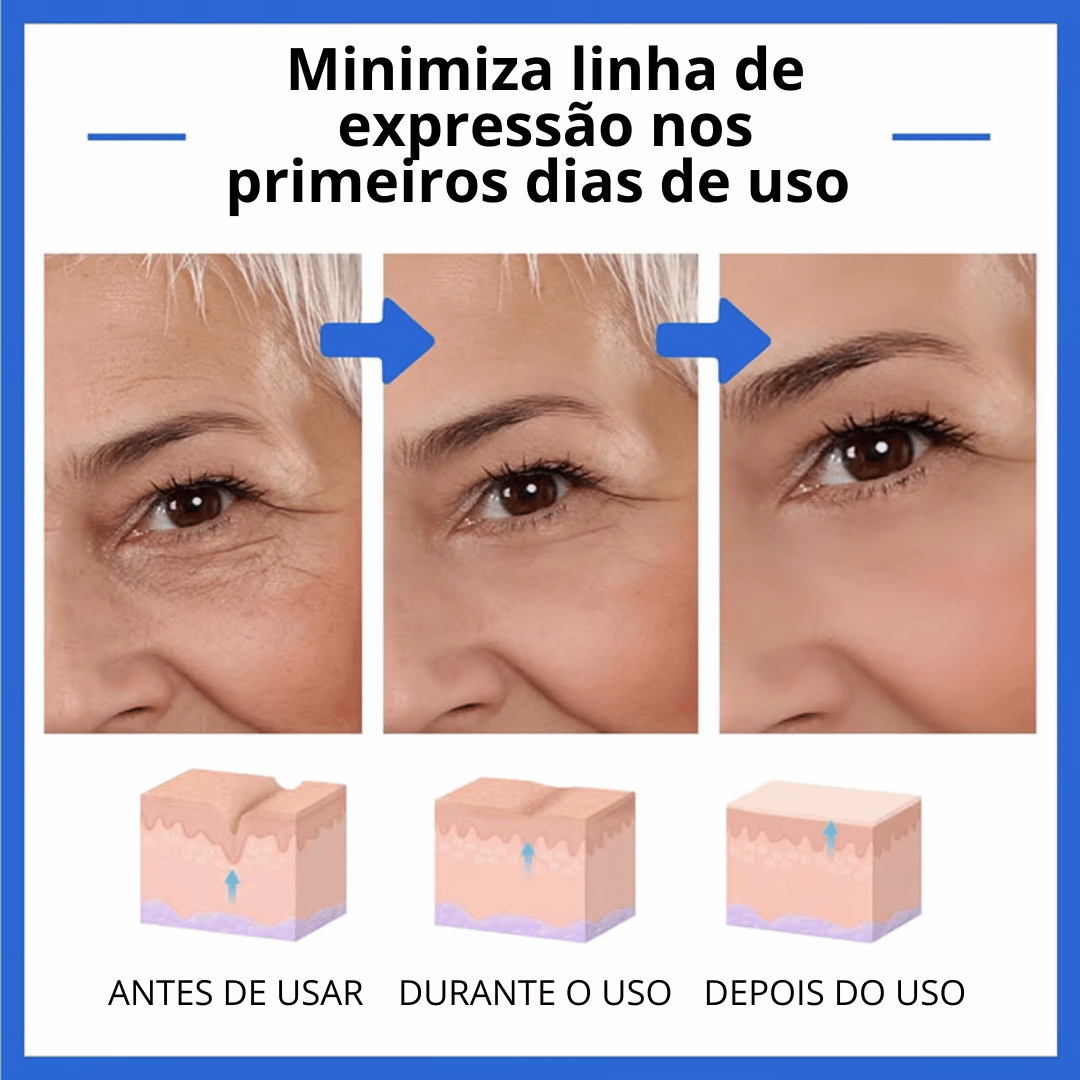 🔥Botox Facial com a ação de DENTRO PARA FORA - LONGEVION o Suplemento Rejuvenescedor com 60 capsulas