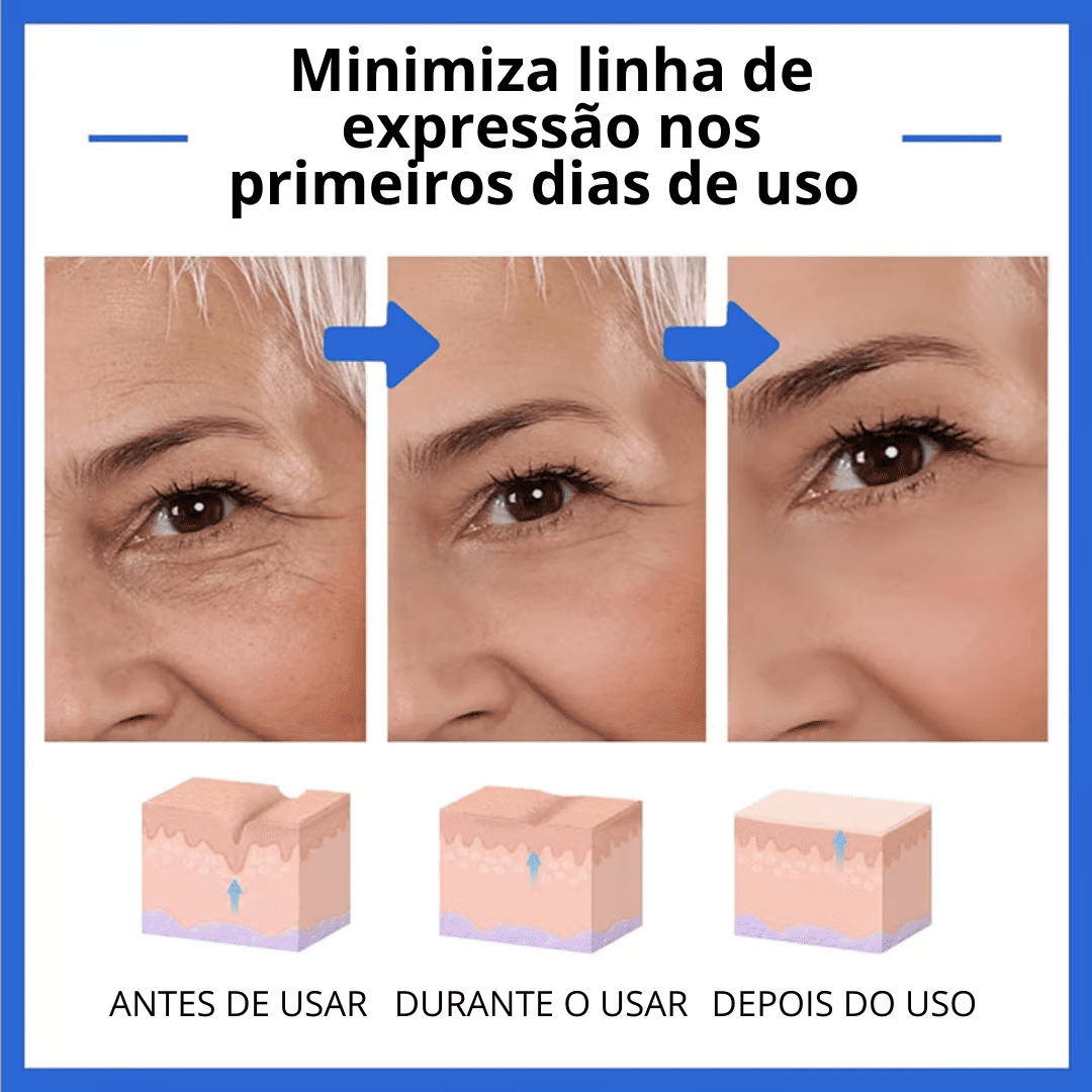 CHEGA AO BRASIL O QUERIDINHO DAS AMERICANAS - 🔥Botox Facial em forma de Sérum - BOTOX STOCK SOLUTION o Sérum Rejuvenescedor com 30ml