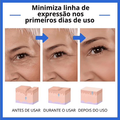 CHEGA AO BRASIL O QUERIDINHO DAS AMERICANAS - 🔥Botox Facial em forma de Sérum - BOTOX STOCK SOLUTION o Sérum Rejuvenescedor com 30ml