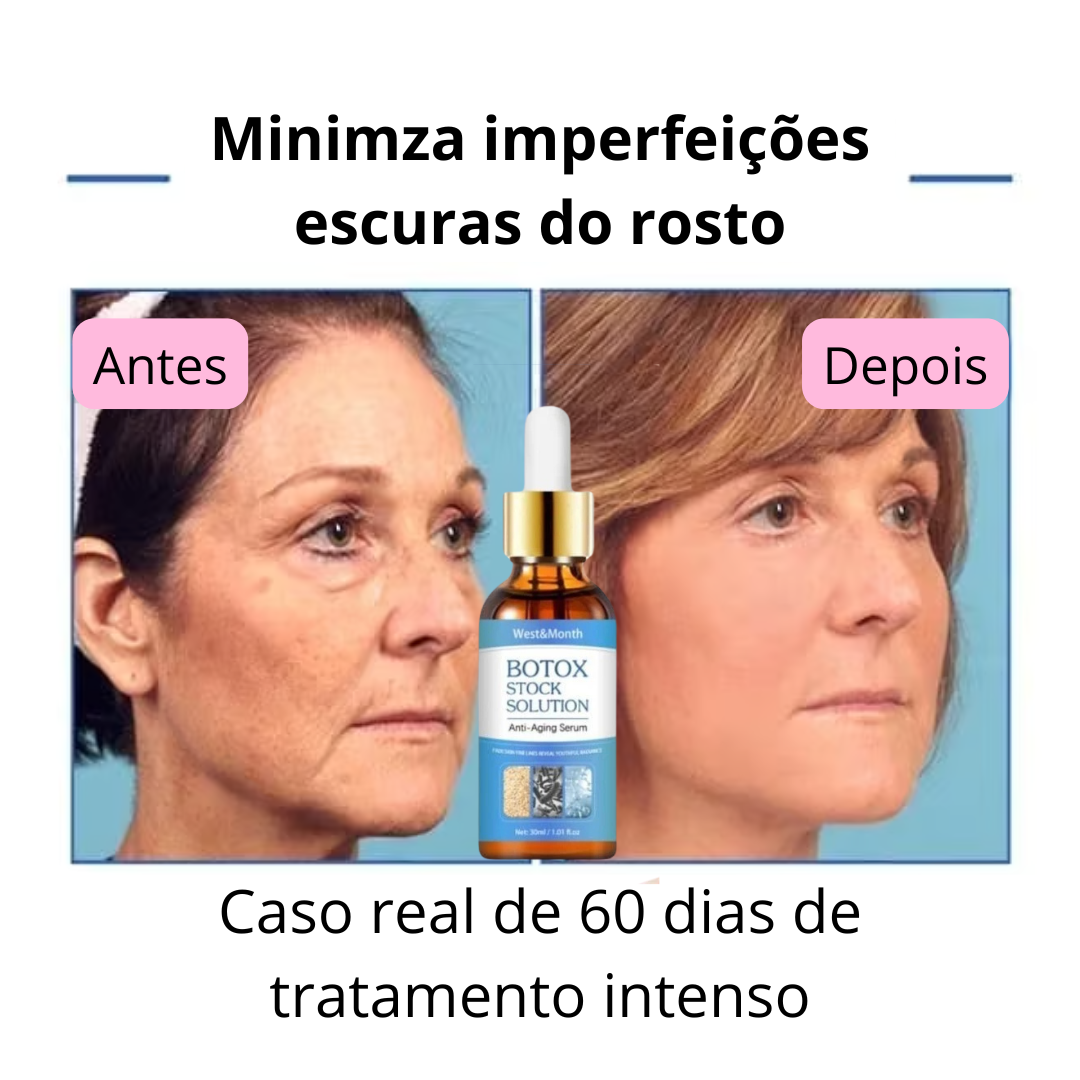 AMERICAN WOMEN'S FAVORITE COMES TO BRAZIL - 🔥Facial Botox in the form of Serum - BOTOX STOCK SOLUTION the Rejuvenating Serum with 30ml 