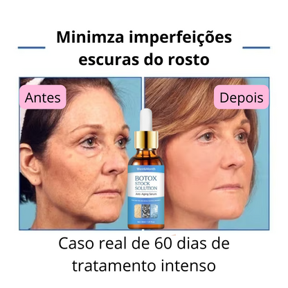 CHEGA AO BRASIL O QUERIDINHO DAS AMERICANAS - 🔥Botox Facial em forma de Sérum - BOTOX STOCK SOLUTION o Sérum Rejuvenescedor com 30ml