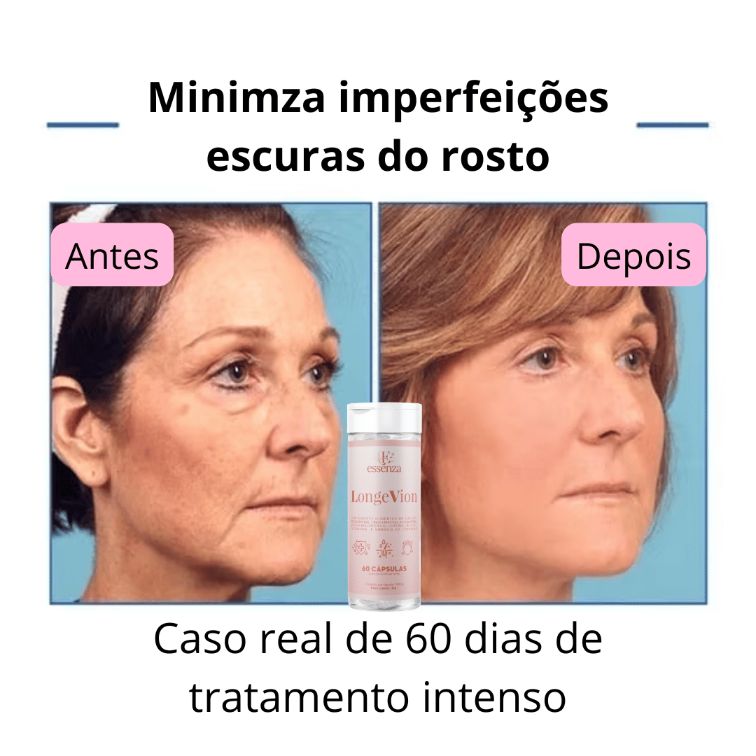 🔥Botox Facial com a ação de DENTRO PARA FORA - LONGEVION o Suplemento Rejuvenescedor com 60 capsulas