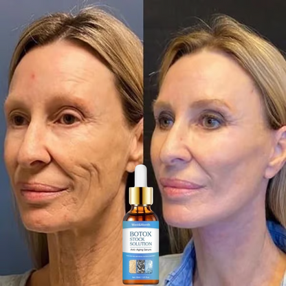 CHEGA AO BRASIL O QUERIDINHO DAS AMERICANAS - 🔥Botox Facial em forma de Sérum - BOTOX STOCK SOLUTION o Sérum Rejuvenescedor com 30ml