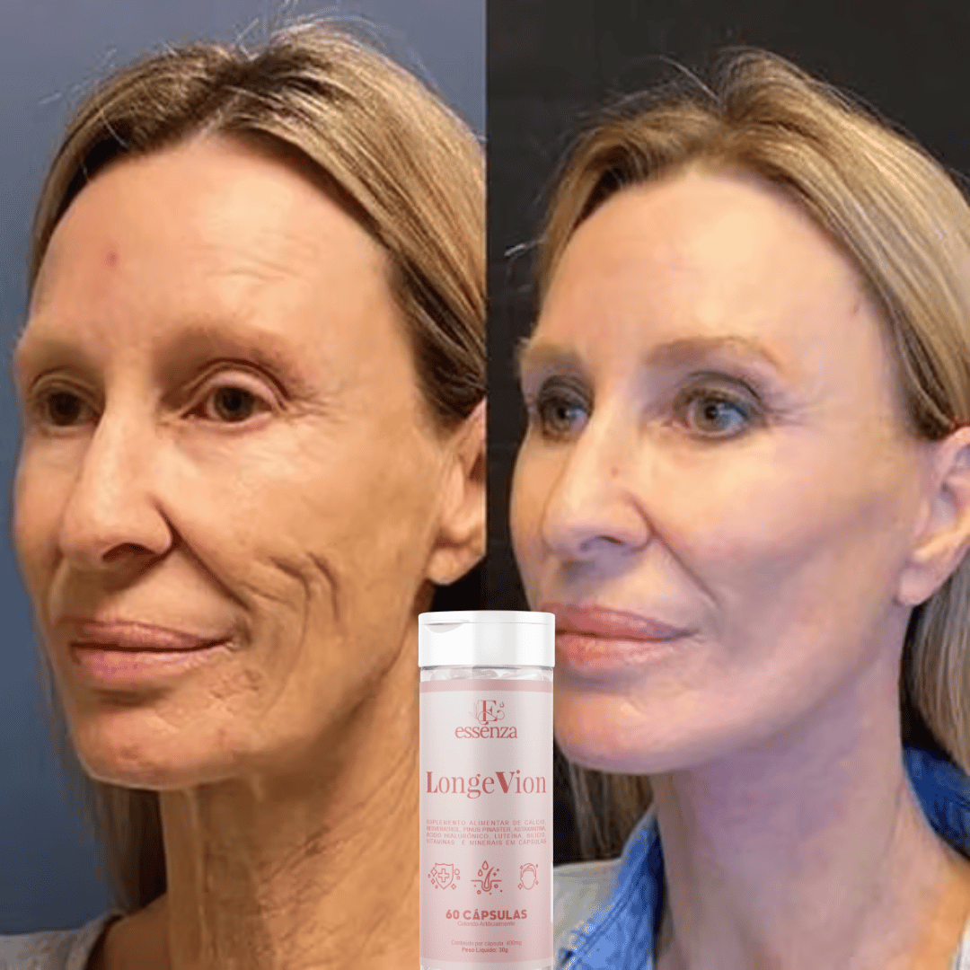 🔥Botox Facial com a ação de DENTRO PARA FORA - LONGEVION o Suplemento Rejuvenescedor com 60 capsulas