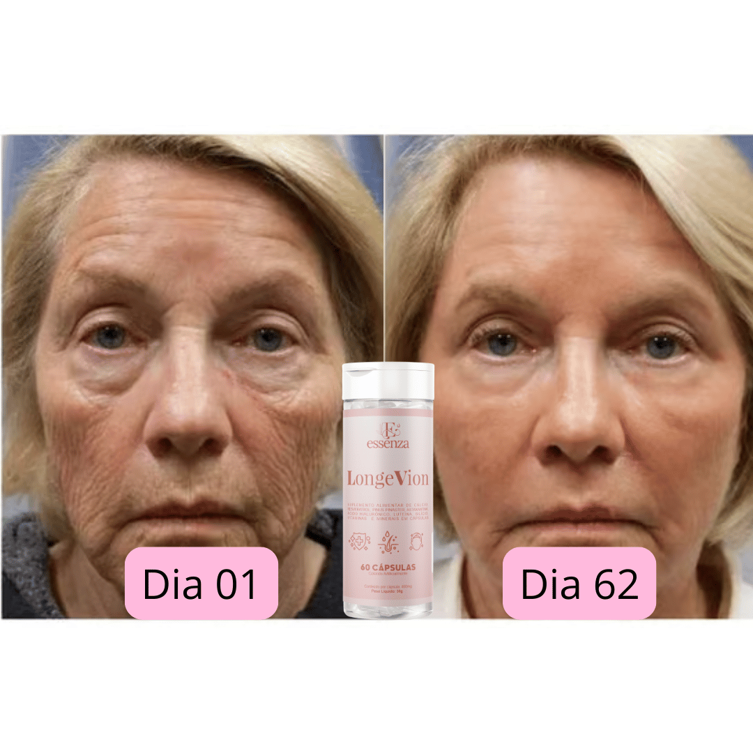 🔥Botox Facial com a ação de DENTRO PARA FORA - LONGEVION o Suplemento Rejuvenescedor com 60 capsulas