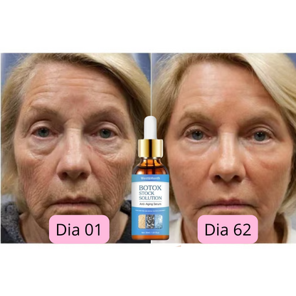 CHEGA AO BRASIL O QUERIDINHO DAS AMERICANAS - 🔥Botox Facial em forma de Sérum - BOTOX STOCK SOLUTION o Sérum Rejuvenescedor com 30ml