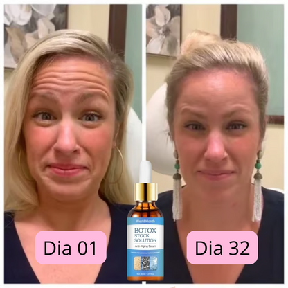 CHEGA AO BRASIL O QUERIDINHO DAS AMERICANAS - 🔥Botox Facial em forma de Sérum - BOTOX STOCK SOLUTION o Sérum Rejuvenescedor com 30ml